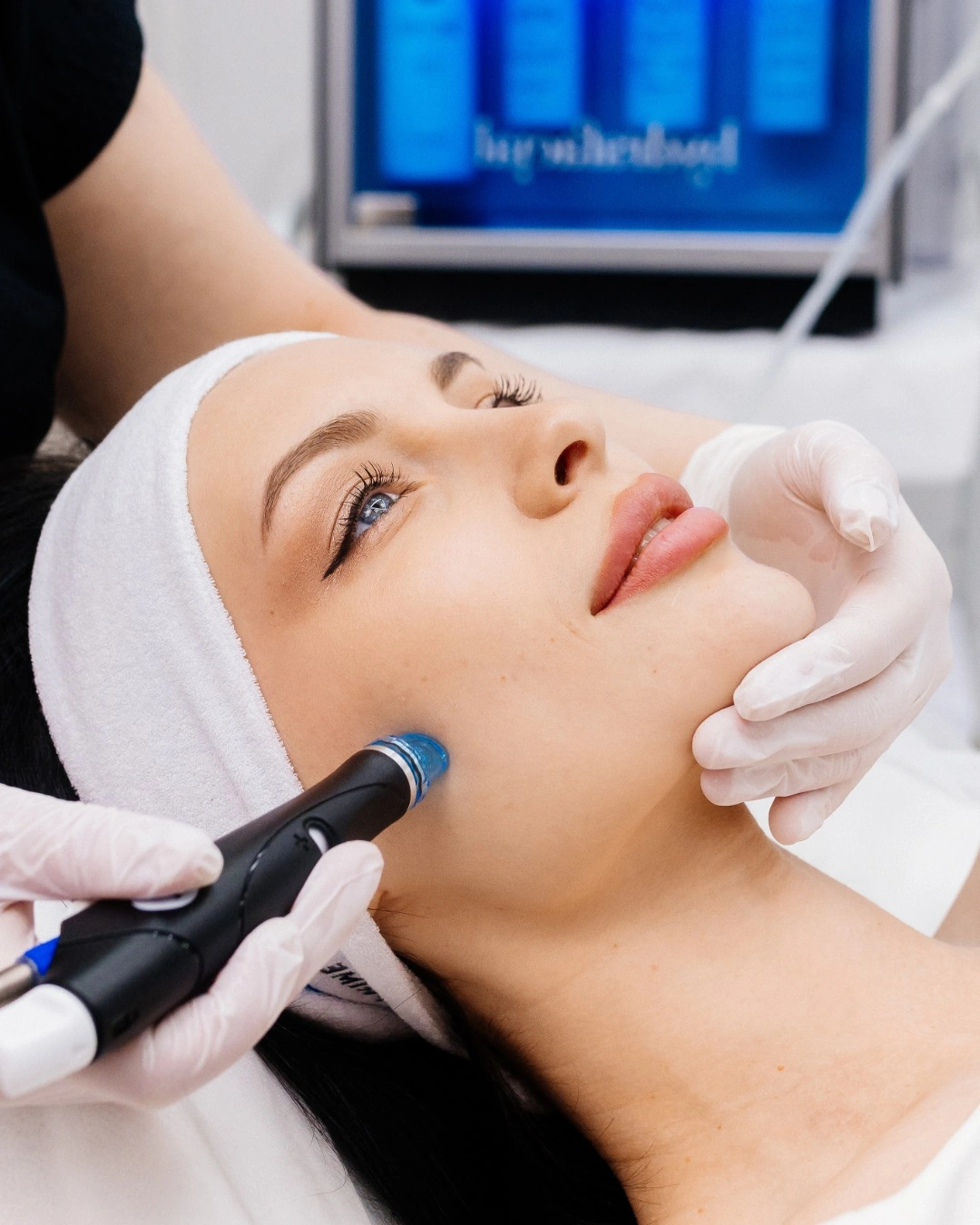Sieviete ar tīru un mirdzošu ādu pēc HydraFacial procedūras